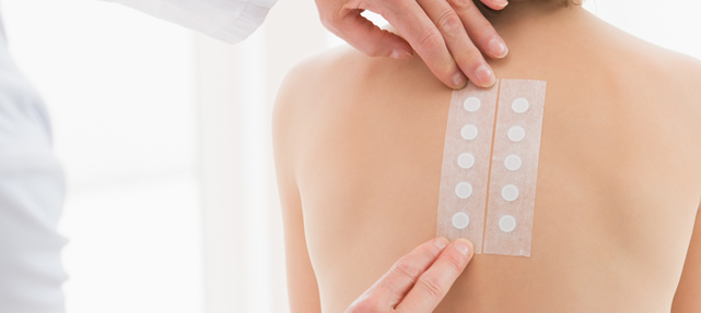 Allergy Patch Testing